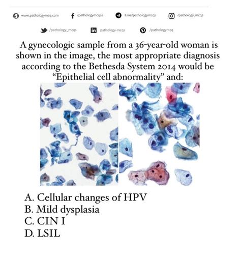 Pathology Mcq On Tumblr