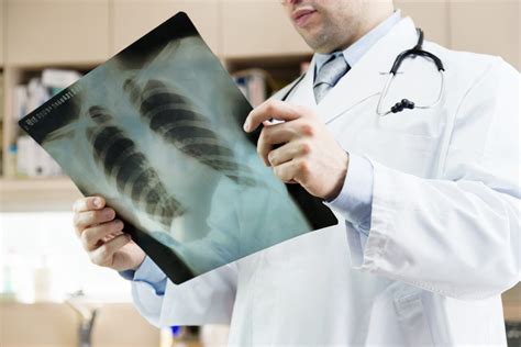 Pulmonary Fibrosis Stages