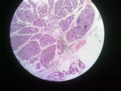 Autonomic Ganglia Histology | howMed Images