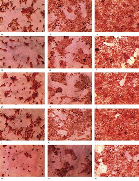 Adherent Morphology Of Hacat Cells Seeded Onto The Composite Surfaces