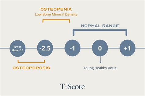 Osteopenia Medications What You Need To Know