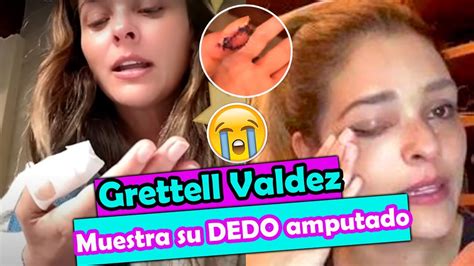 😭grettell Valdez Revela Cómo Contrajo El Virus Que Le Fue Extirpado De Su Dedo Youtube