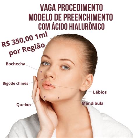 Vaga Procedimento Modelo Preenchimento Facial Cido Hialur Nico Em