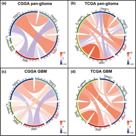 Ikbip Is A Novel Emt Related Biomarker And Predicts Poor Survival In Glioma