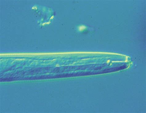 Why Are Nematodes Hurting Your Plants? | Dengarden