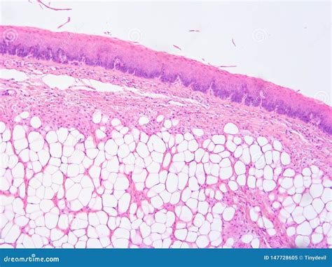 Epiglottis Histology