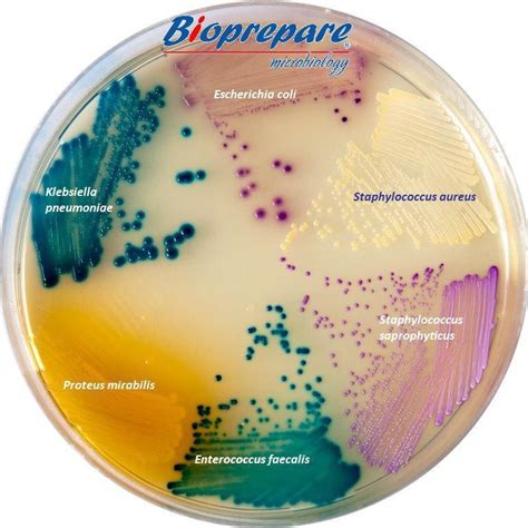 Chromagar Candida Θρεπτικό Υλικό σε Τρυβλίο Lazos Medical