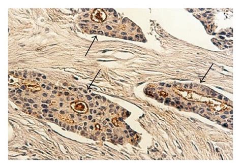 Histochemical Staining With Wisteria Floribunda Agglutinin WFA Of