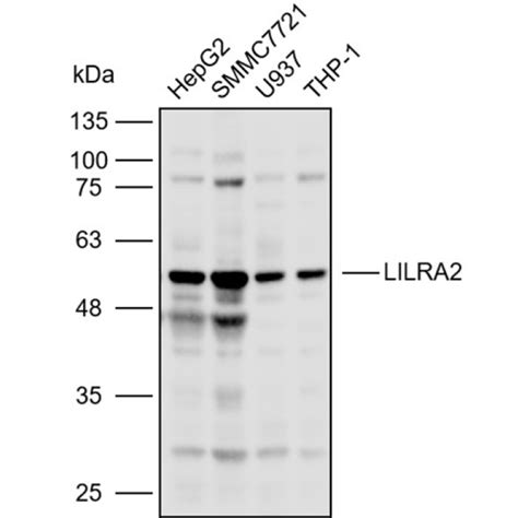 Solarbio K P Anti Lilra Polyclonal Antibody