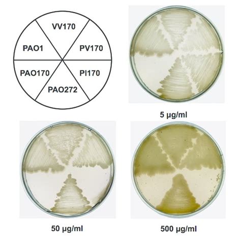 Twitching Swimming And Swarming Motility Of P Aeruginosa Strains