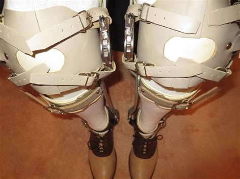 Leg Braces Pair Full Leg Metal And Leather Polio Etsy