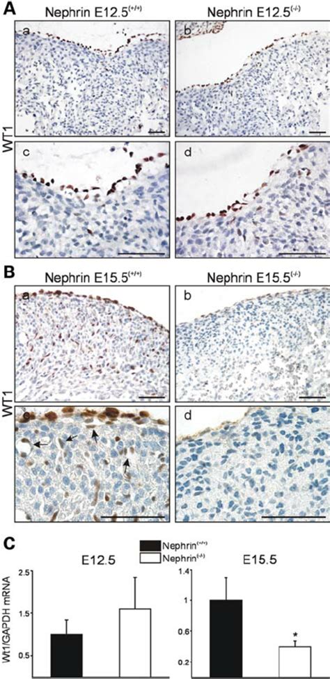 Wt1 Expression Becomes Reduced During Embryonic Development In Nephrin Download Scientific