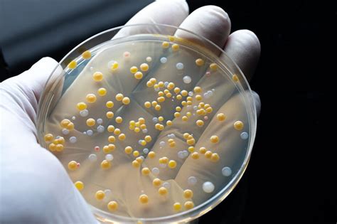 Academics Warn Prime Minister Of Extremely Serious AMR Consequences