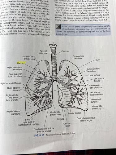 Lung Anatomy Section Flashcards Quizlet