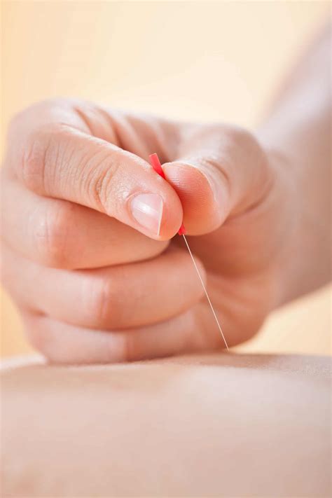 Maplebrook Acupuncture Community Acupuncture