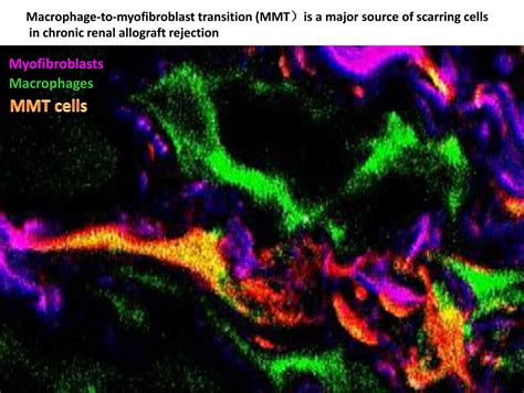 Macrophage To Myofibroblast Tr Image Eurekalert Science News Releases