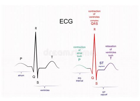 Chest Ecg Leads Placement Illustration Six Colored Electrocardiography