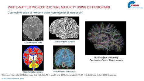 Clinical Mr Imaging Cibm Center For Biomedical Imaging