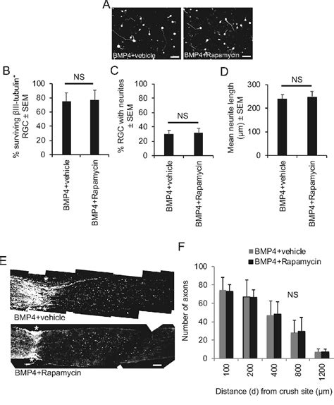 Figure 6 From Activation Of The BMP4 Smad1 Pathway Promotes Retinal