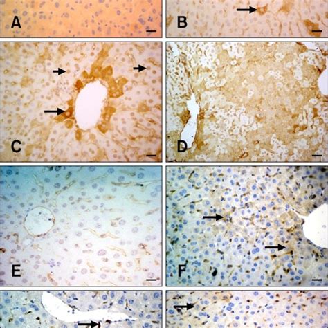 H E TUNEL And Caspase 8 Specific Immunohistochemistry In Hepatocytes