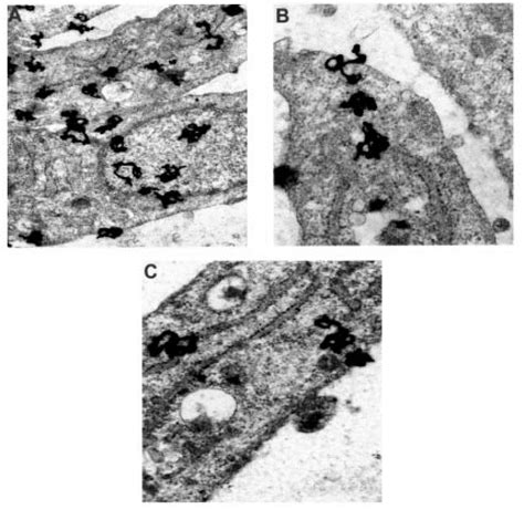 Electron Microscopic Autoradiography Of Cultured Human Broblasts Fed