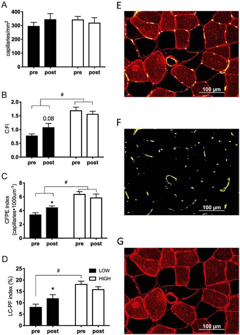 Figure 2 From Low Skeletal Muscle Capillarization Limits Muscle