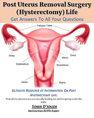 POST UTERUS REMOVAL SURGERY (HYSTERECTOMY) LIFE: A MUST-READ BOOK FOR ALL THE WOMEN, WHO ARE ...