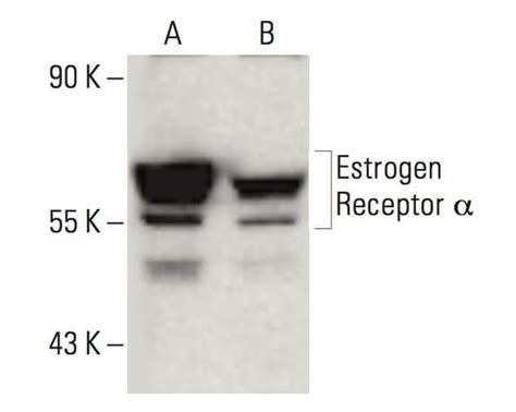 Estrogen Receptor Alpha Antibody H226 SCBT Santa Cruz Biotechnology