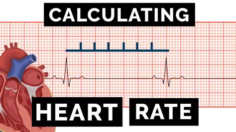 Calculating Heart Rate On An Ecg Ekg Osce Guide Ukmla Cpsa