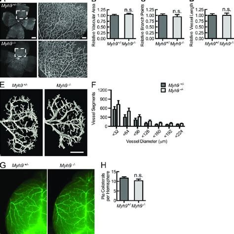 Despite Adequate Macrophage Recruitment To Ischemic Muscle Tissue