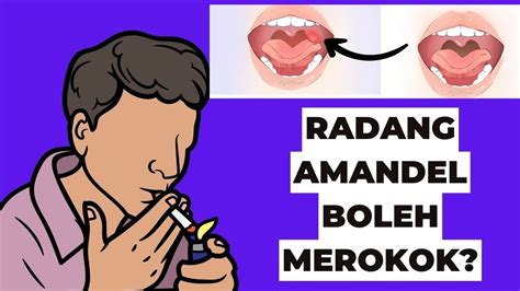 Efek Rokok Bagi Penderita Radang Amandel YouTube