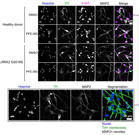 Phenotypic Profiling Of Human Stem Cell Derived Midbrain Dopaminergic