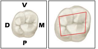 Anatomia Do Primeiro Molar Superior Resumo De Anatomia Dental