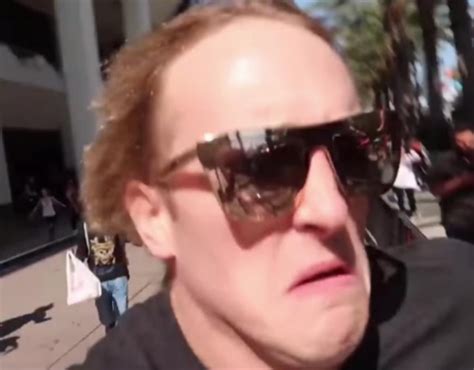 Pyro What Is Your Hairline Rpyrocynical