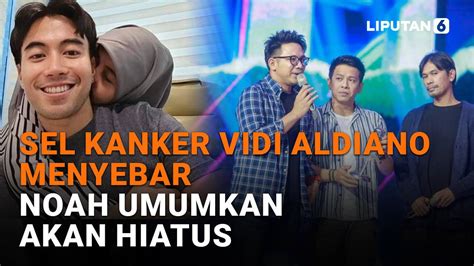 Sel Kanker Vidi Aldiano Menyebar NOAH Umumkan Akan Hiatus