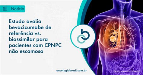 Anvisa Aprova Nova Op O De Tratamento Pembrolizumabe Para C Ncer