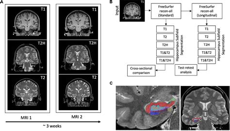 Frontiers Comparison And Reliability Of Hippocampal Subfield