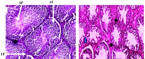 Photomicrograph Of Transverse Section Of The Testis A Control Groups