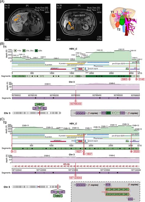 The Local Haplotype Of Hbvintegrated Genomic Region In Chr Of T And