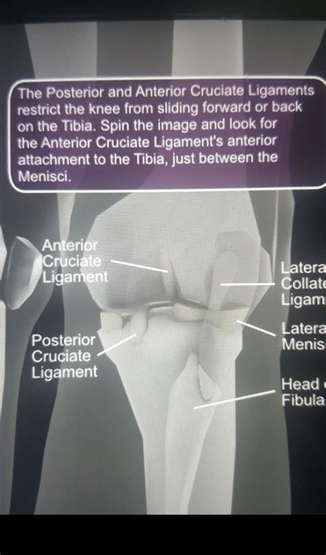 Anterior Cruciate Ligament Surgery All You Need To Know Peak Physio