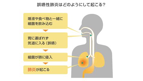 【介護予防コラム㉔】お食事前の1分筋トレで、誤嚥性肺炎を防ぐ！｜お知らせ｜桜十字の新感覚リハビリジム Letsリハ！