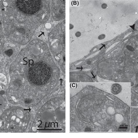 Electron Micrograph Of A Sertoli Cell During Spermiogenesis In October