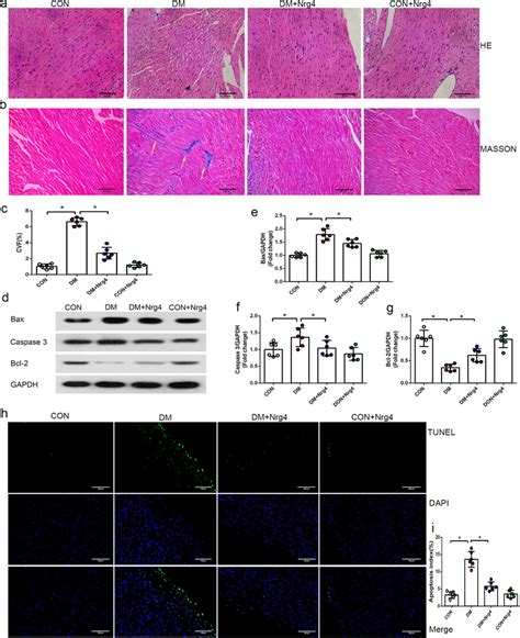 Nrg4 Alleviates Cardiac Fibrosis And Cardiomyocyte Apoptosis A Left