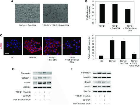 Tgf B1smad Odn Effectively Inhibits Activated Hscs By Tgf B1 A