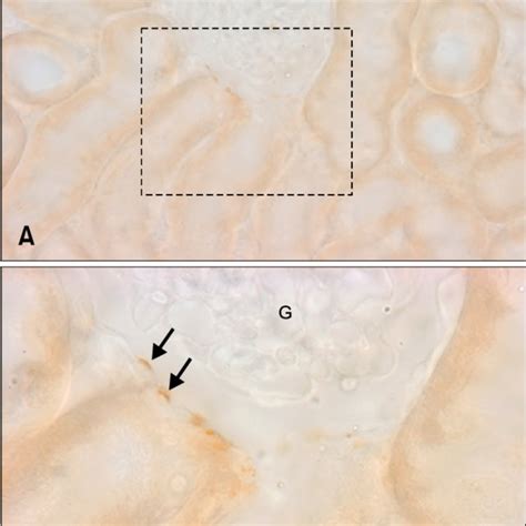 Transmission Electron Micrographs Illustrating Opn Immunostaining In