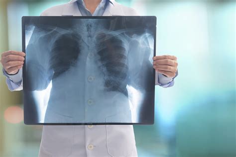 Pulmonary Emphysema Causes Symptoms Diagnosis Tests Treatment