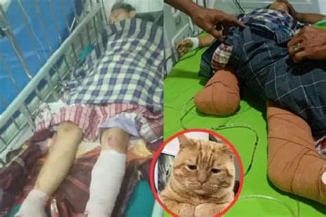 Demi Selamatkan Seekor Kucing Kedua Kaki Anak SD Terlindas Truk Dan