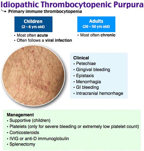 Thrombocytopenic Purpura