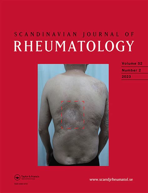 Sex Hormones And Autoimmune Rheumatic Disorders Scandinavian Journal Of Rheumatology Vol 18 No 2