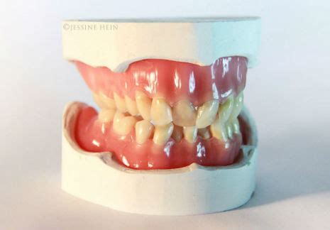 Artist creates dentures of David Bowie’s old teeth | Dangerous Minds